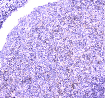 UBE2I UBC9 Antibody