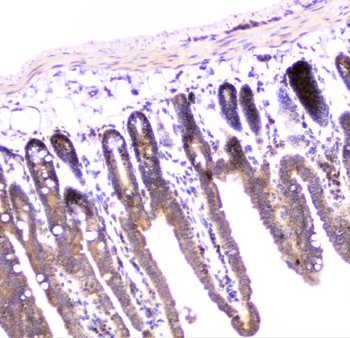 UBE2I UBC9 Antibody