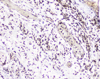 UBE2I UBC9 Antibody