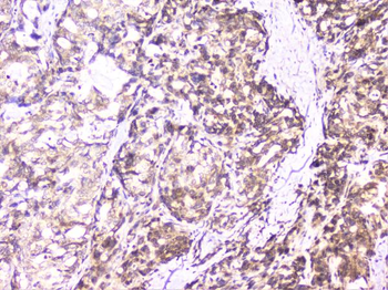 UBE2I UBC9 Antibody