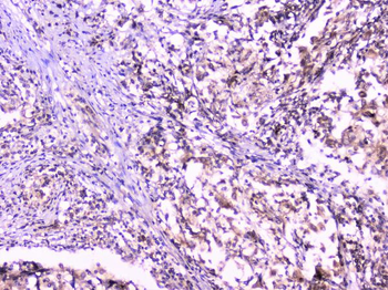 UBE2I UBC9 Antibody