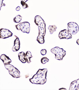 UBE2I UBC9 Antibody