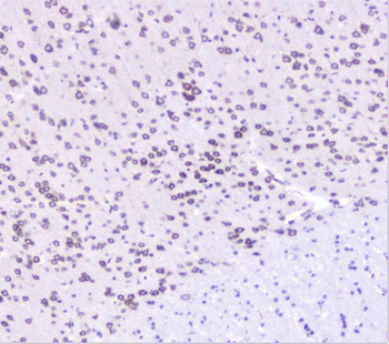 UBE2I UBC9 Antibody