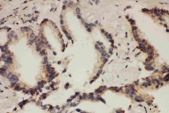 Cullin 1/Cul1 Rabbit Polyclonal Antibody