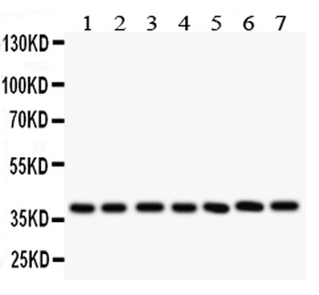 Leukemia inhibitory factor LIF Rabbit Polyclonal Antibody