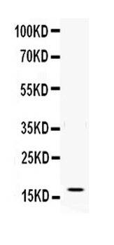 IFN gamma Rabbit Polyclonal Antibody