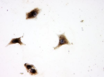 SQSTM1/p62 Antibody
