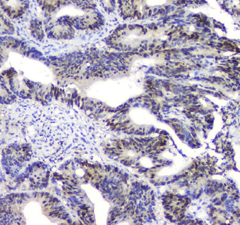 SQSTM1/p62 Antibody