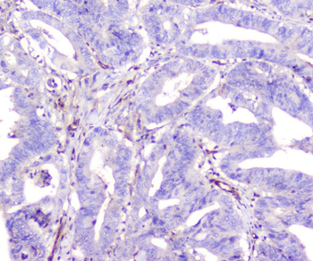 ADA Mouse Monoclonal Antibody