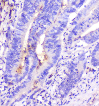 ADA Mouse Monoclonal Antibody