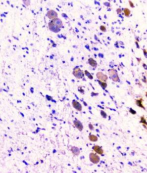CD2AP Antibody (monoclonal, 5F8)