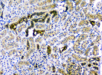 CD2AP Antibody (monoclonal, 5F8)