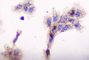 CD2AP Antibody (monoclonal, 5F8)