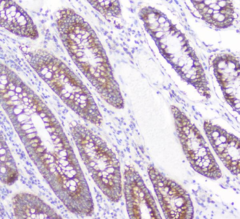CD2AP Antibody (monoclonal, 5F8)