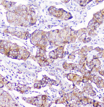 CD2AP Antibody (monoclonal, 5F8)