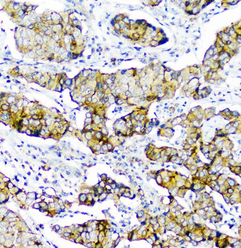 CD2AP Antibody (monoclonal, 5F8)