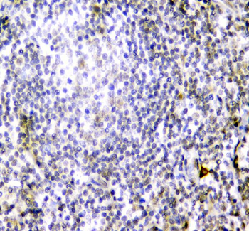 CD84 Rabbit Polyclonal Antibody