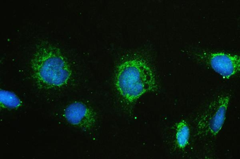 Hyaluronan synthase 1/HAS1 Antibody