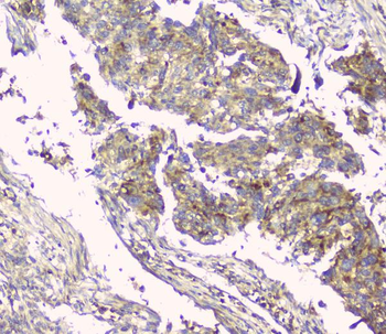 Hyaluronan synthase 1/HAS1 Antibody