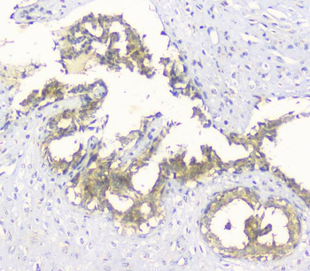Hyaluronan synthase 1/HAS1 Antibody