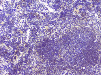 Hyaluronan synthase 1/HAS1 Antibody