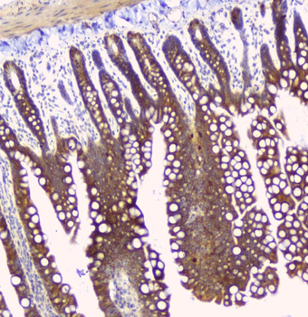 Hyaluronan synthase 1/HAS1 Antibody
