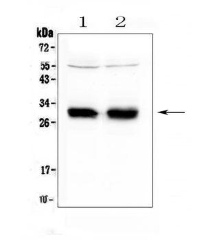 HLA Class II DRB1/HLA-DRB1 Rabbit Polyclonal Antibody
