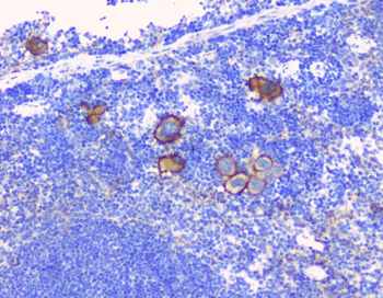 CD229/LY9 Rabbit Polyclonal Antibody