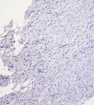 Myelin oligodendrocyte glycoprotein/MOG Antibody