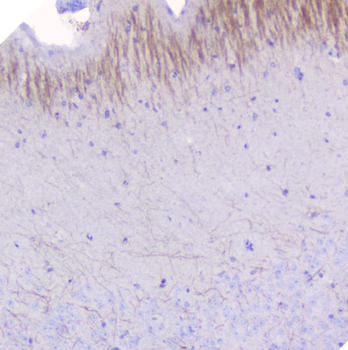 Myelin oligodendrocyte glycoprotein/MOG Antibody