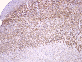 Myelin oligodendrocyte glycoprotein/MOG Antibody