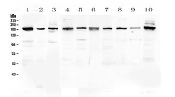 PCDH15 Antibody