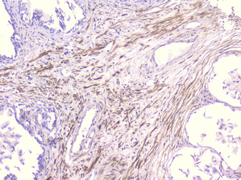 PCDH15 Antibody