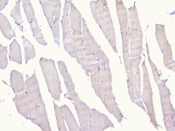 PCDH15 Antibody