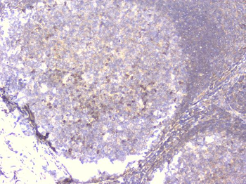 PCDH15 Antibody