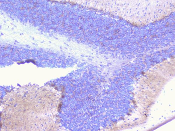 PCDH15 Antibody