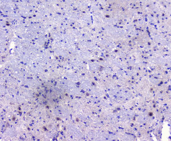 PCDH15 Antibody