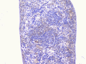 PCDH15 Antibody