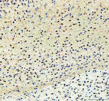 PKC beta 1/PRKCB Rabbit Polyclonal Antibody