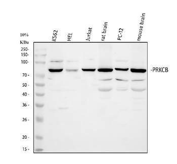 PKC beta 1/PRKCB Rabbit Polyclonal Antibody