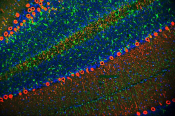 PKC gamma/PRKCG Antibody