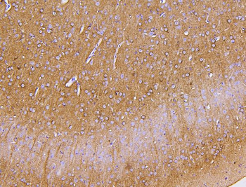 PKC gamma/PRKCG Antibody