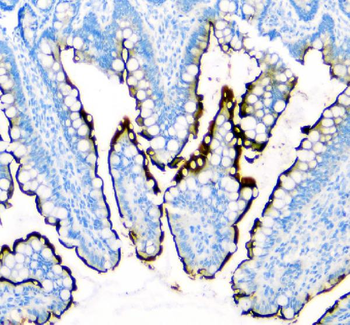 SI Rabbit Polyclonal Antibody