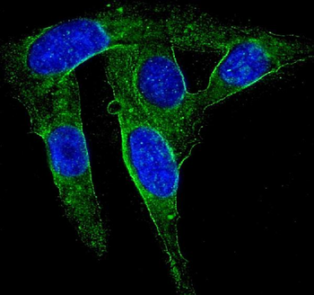 HSD17B1 Rabbit Polyclonal Antibody