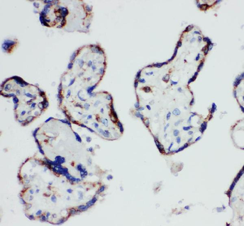 HSD17B1 Rabbit Polyclonal Antibody