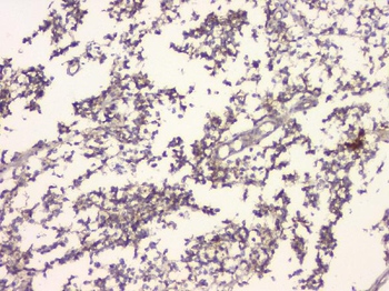 APP/C99 Rabbit Polyclonal Antibody