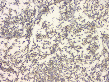 APP/C99 Rabbit Polyclonal Antibody