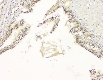 APP/C99 Rabbit Polyclonal Antibody