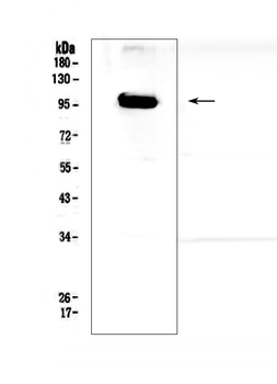APP/C99 Rabbit Polyclonal Antibody