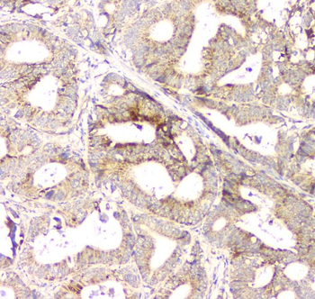 Aprt Rabbit Polyclonal Antibody